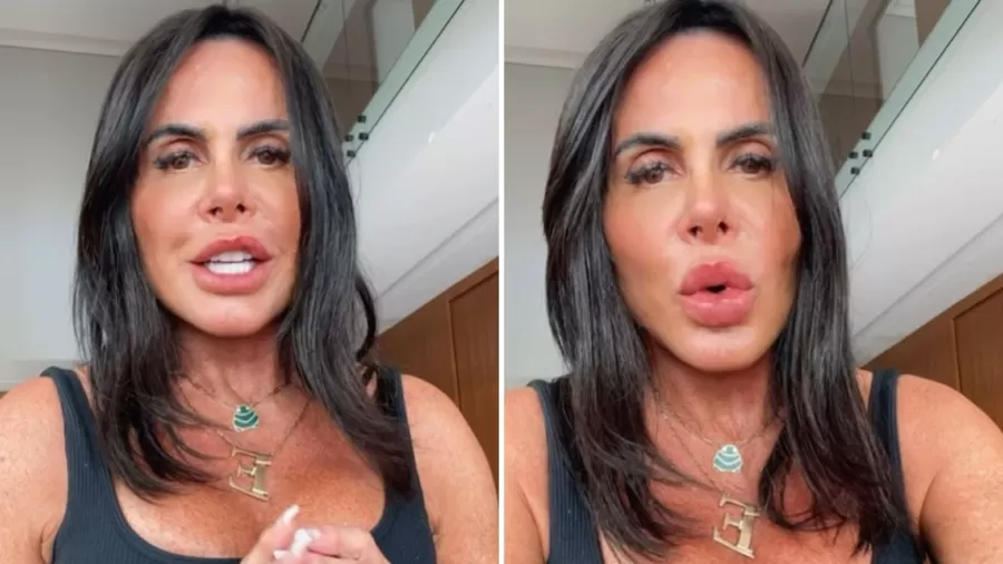 Gretchen mostra novo rosto após procedimento Imagem: Reprodução/Instagram